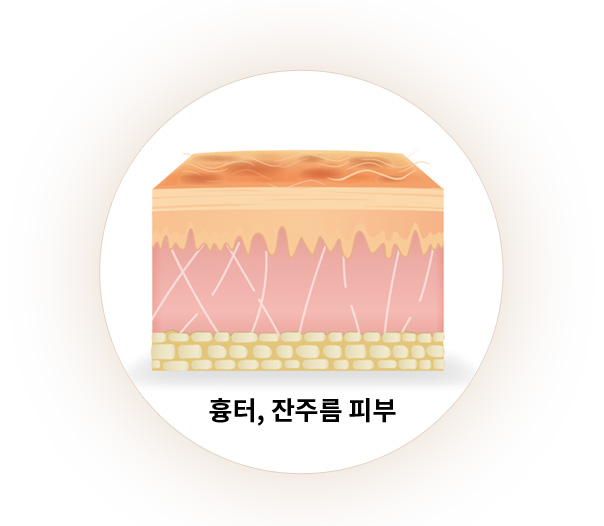 흉터, 잔주름 피부