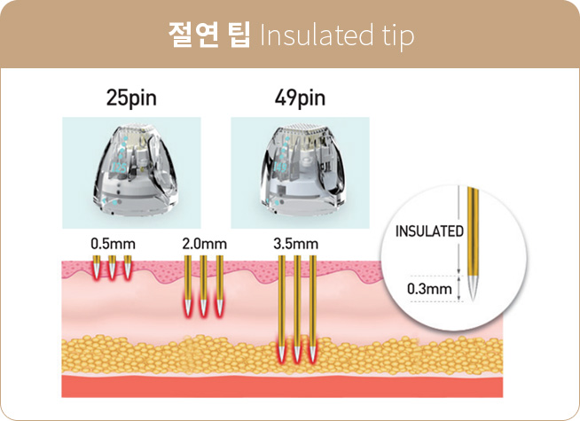 절연 팁 Insulated tip