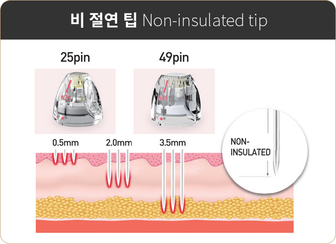 비 절연 팁 Non-insulated tip
